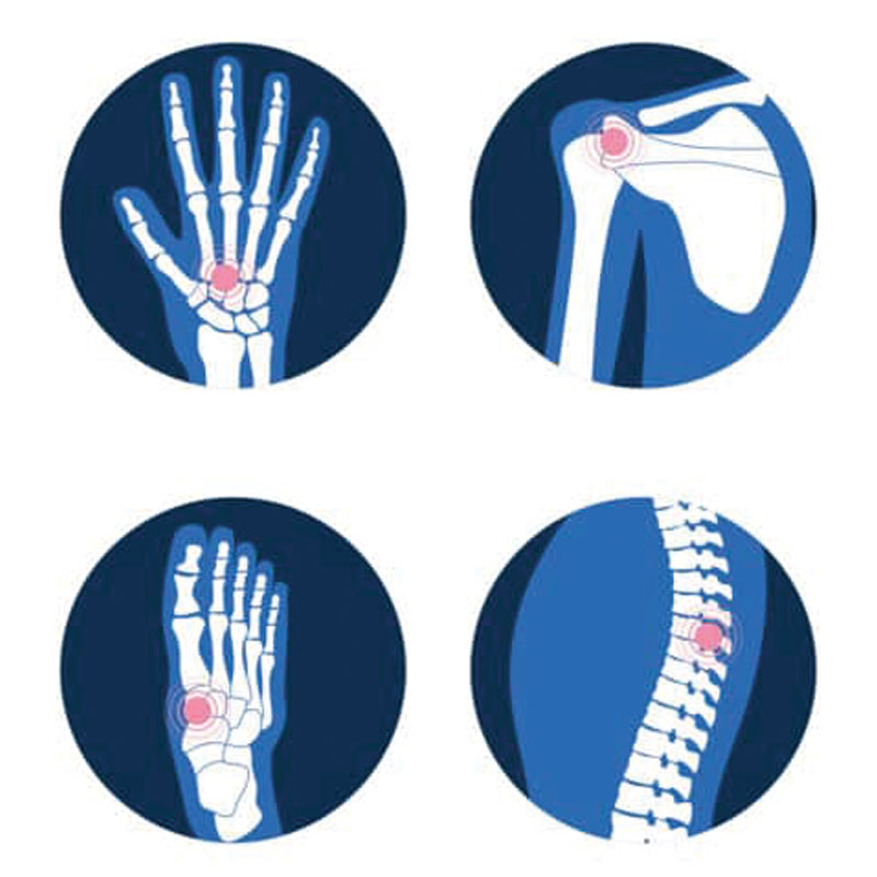 Arthritis pain relief